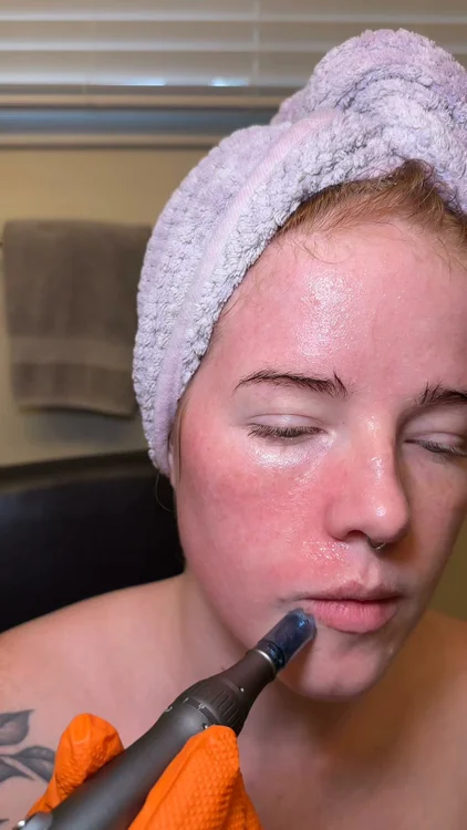 The at-home treatment everyone’s switching to