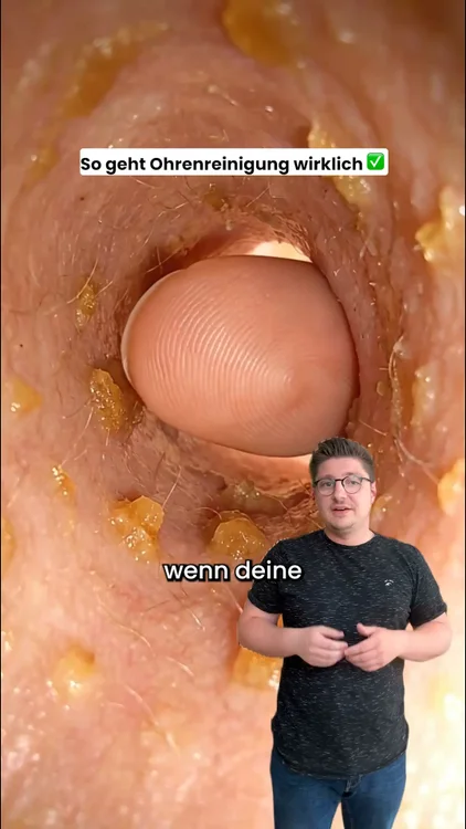 Ohren reinigen wie ein Profi
