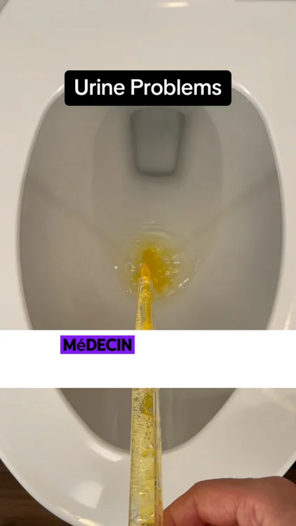 J’ai enfin retrouvé mon confort urinaire