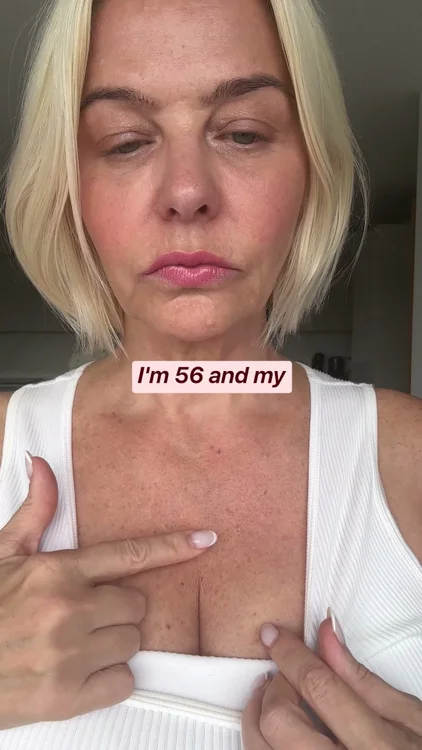 My Arms Stopped Responding To Creams