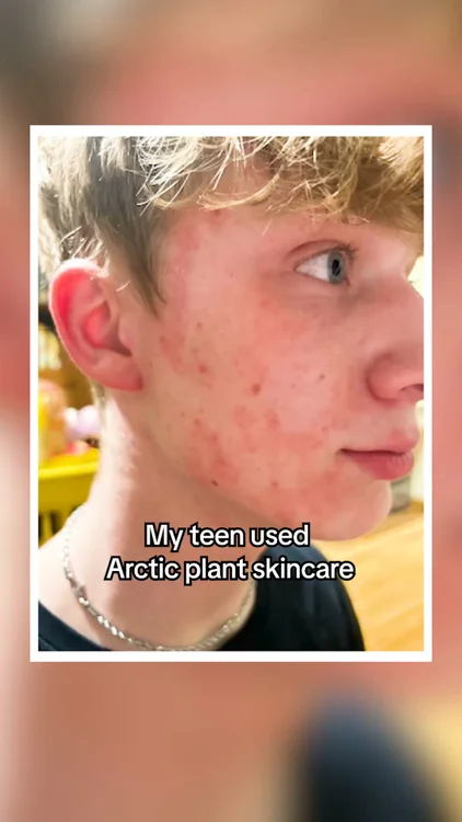 Stop Destroying Your Skin
