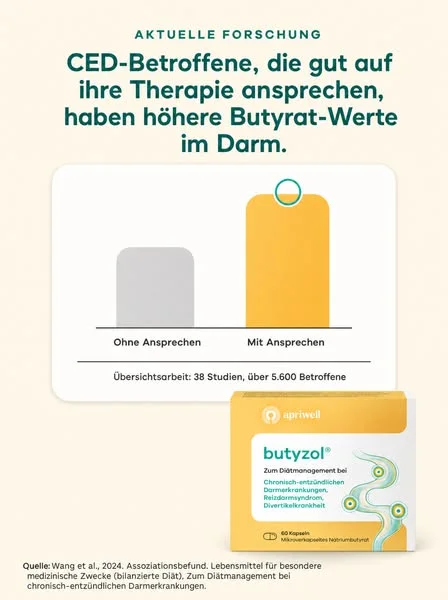 Beschwerden bei Divertikulitis?