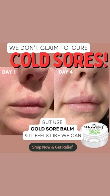 Thousands Trust Cold Sore Stuff