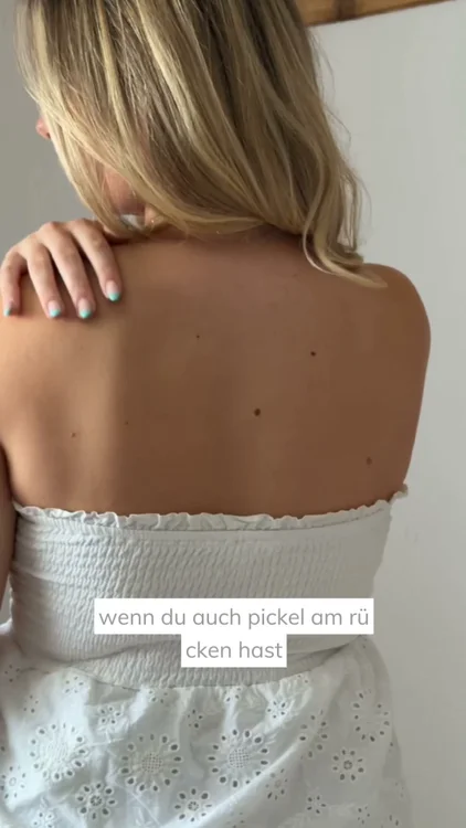 Endlich wieder rückenfrei
