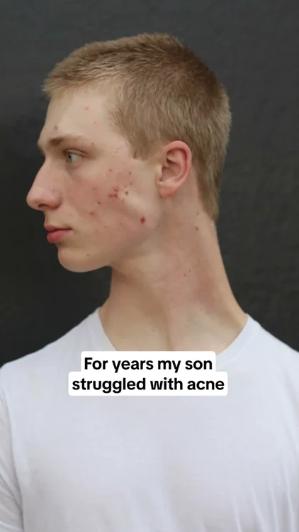 Stop Destroying Your Skin