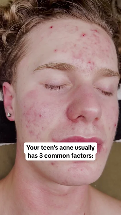 99% of “Skincare” Destroy your Skin Barrier